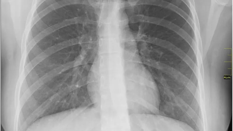 Equipamento de radiografia usado por técnico em radiologia