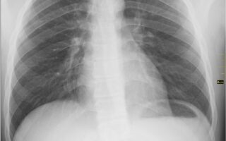 Curso técnico em Radiologia: estudante realiza exame de imagem em equipamento de raio X
