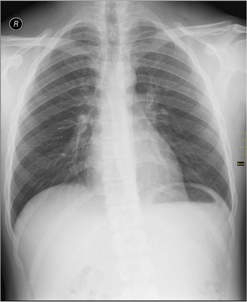 Curso técnico em Radiologia: estudante realiza exame de imagem em equipamento de raio X