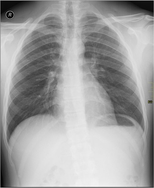 Curso técnico em Radiologia: estudante realiza exame de imagem em equipamento de raio X