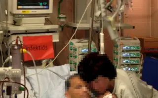 Paciente em leito de UTI com monitorização hospitalar, em artigo sobre técnico de enfermagem em UTI