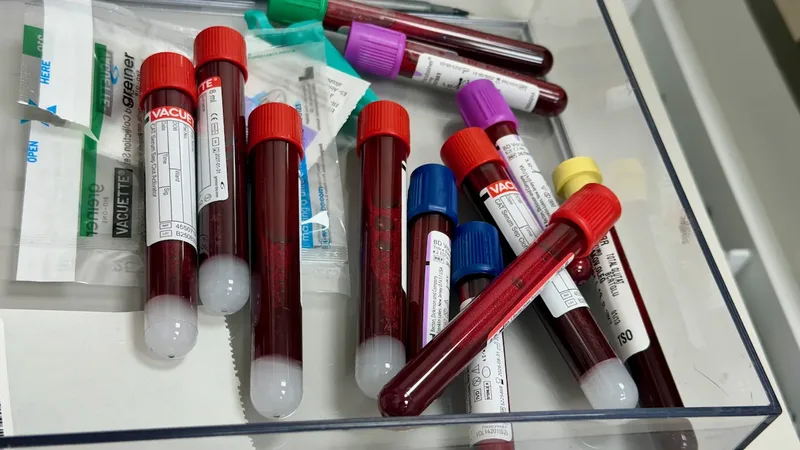 Amostras em tubos para análise química em laboratório